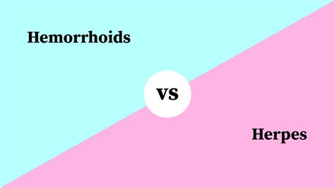 Differences Between Hemorrhoids And Herpes