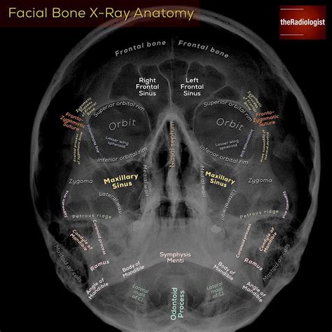 Radiographic Anatomy Of Facial Bones Radiology Medical Radiography My