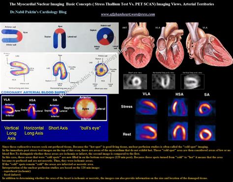 Drnabil Paktins Cardiology Blog مجله کاردیولوژی دکتور نبــیل پاکطـین