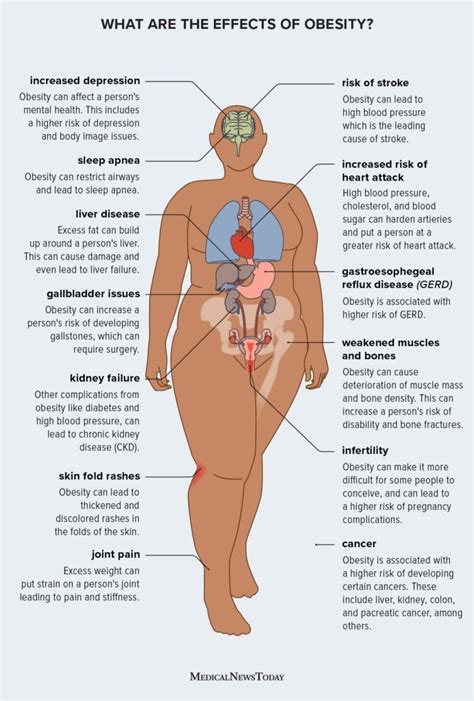 Obesity How It Affects The Body