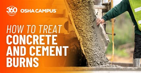 How To Treat Concrete And Cement Burns On The Skin