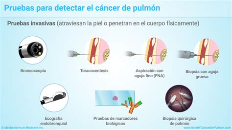 Presentación De Diapositivas Diagnóstico Y Detección Del Cáncer De Pulmón