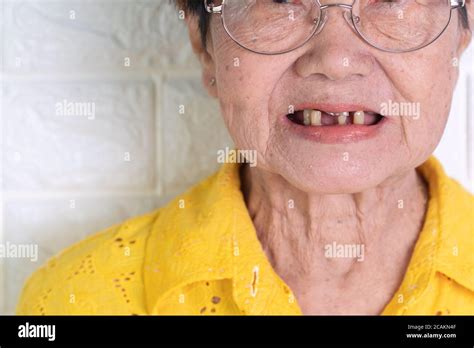 asian elderly woman over 70 years old be smile with a few broken teeth here have problem of