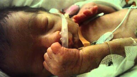 Priscilla 30 Weeks Premature Baby Youtube