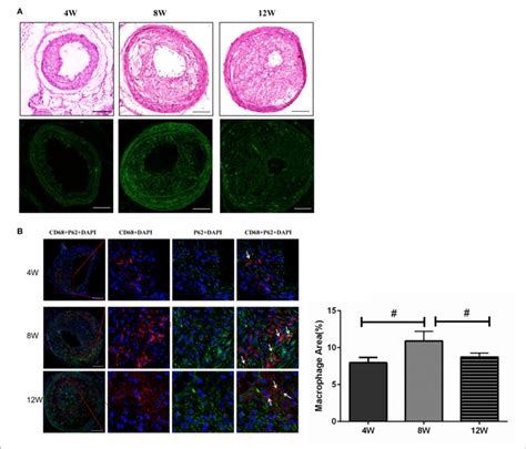 Macrophage Autophagy In Atherosclerotic Plaques In Apoe Mice A