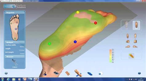 Laserfootscancomputerscreenshot Podiatry Care