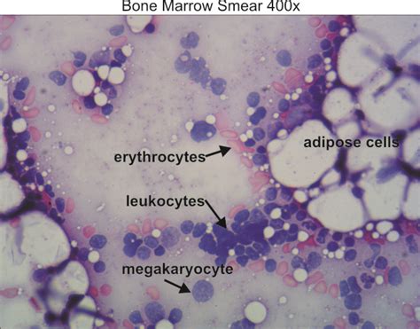 Bone Marrow 400x Dissection Connection