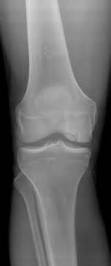 X ray ankle anatomy medical radiologist radiology student radiology medical coding medical anatomy medical imaging. 20-year-old has an incidental finding on his x-ray ...