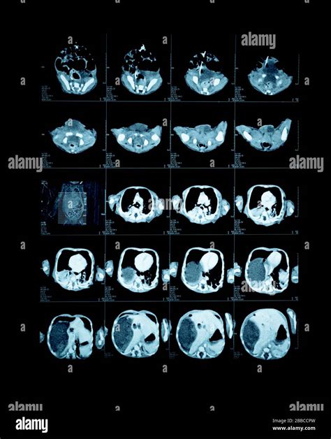 Ct Scan Child Hi Res Stock Photography And Images Alamy
