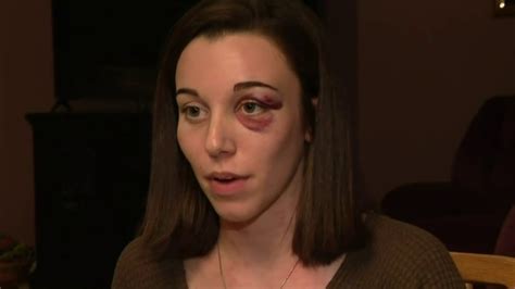 Woman Who Survived Being Crushed By Truck On I 94 Describes Moments