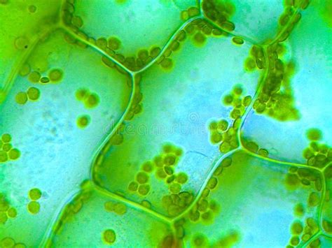 Elodea Water Plant Under Microscope Cell Walls And Chloroplasts Are