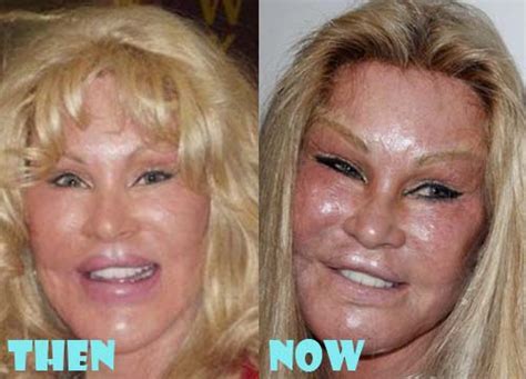 Jocelyn Wildenstein Plastic Surgery Before And After Photos Lovely