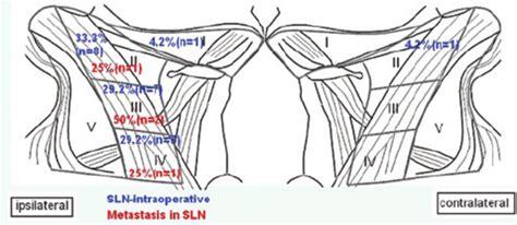 Distribution Of The Sentinel Lymph Nodes Slns Detected During The