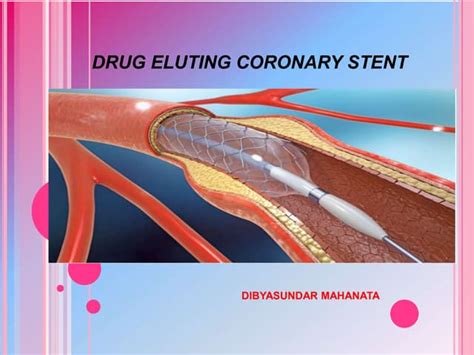 Drug Eluting Coronary Stent Design And Drug Delivery Ppt