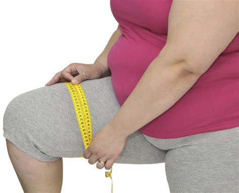 Obesidad M Rbida Causas S Ntomas Y Complicaciones La Gu A De Las Vitaminas