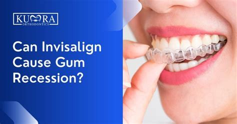 Can Invisalign Cause Gum Recession Kumra Orthodontics