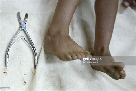 An Iraqi Male Child Is Laid Down To Be Circumcised July 14 2005 In