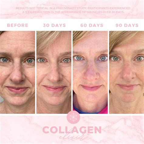 Isagenix Collagen Elixir Before And After Collection Isagenix