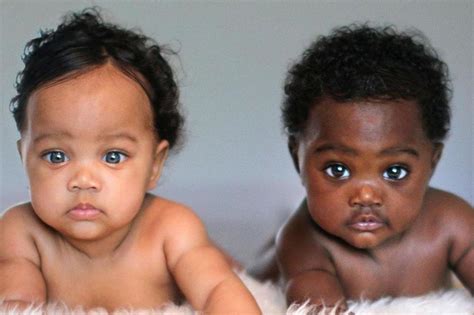 Twin Babies With Different Skin Colours Have Become