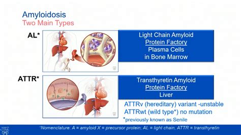 Transthyretin Amyloid And New Treatment Options Mayo Clinic