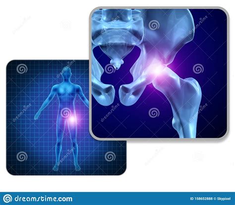 Human Hip Joint Pain Stock Illustration Illustration Of Body 158652888