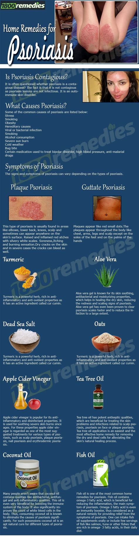 7 Helpful Home Remedies In 2020 Home Remedies For Psoriasis