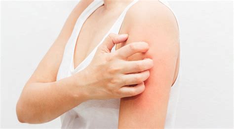 Aquagenic Urticaria Water Allergy Causes Treatment Options Signs