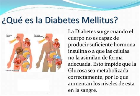 Que Es Diabetes Mellitus