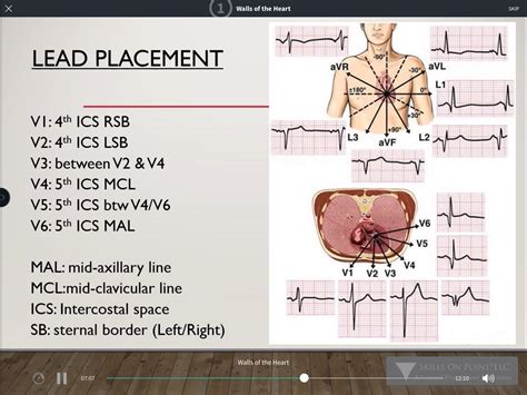 Basic 12 Lead Ekg Interpretation Complete Anatomy