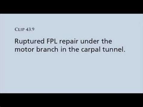 Calculate the tcsa of these tendon (area of ellipse. Repair of FPL tendon under motor branch of median nerve ...