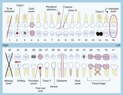 12 The Dental Examination Pocket Dentistry