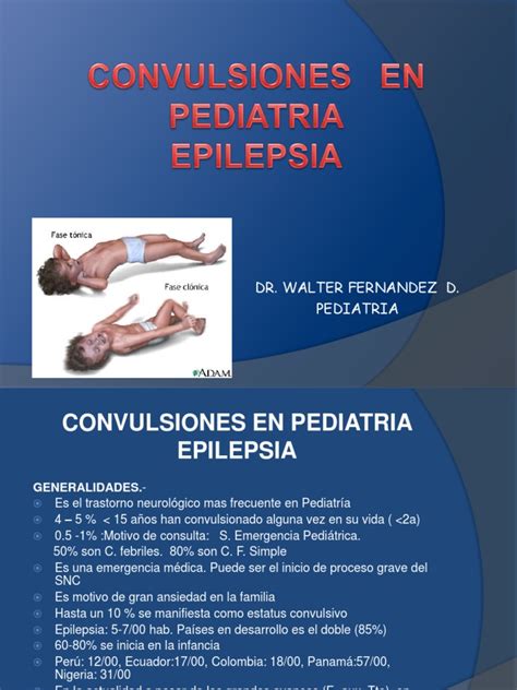 5 Convulsiones En Pediatria Epilepsia Medicina Clinica