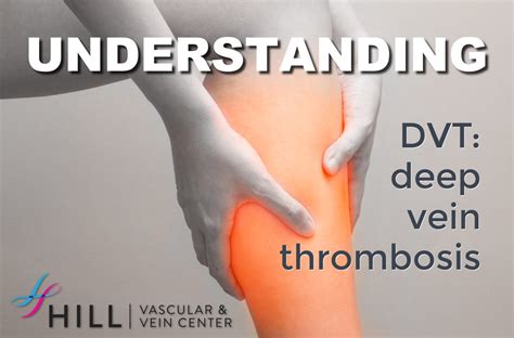 Deep Vein Thrombosis DVT Hill Vascular And Vein Center