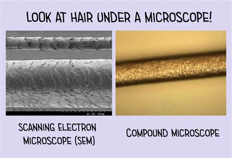 Hair Under A Microscope Rs Science