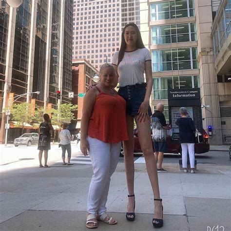Woman With World’s Longest Legs Embraces Her Uniqueness And Inspires Others Laptrinhx News
