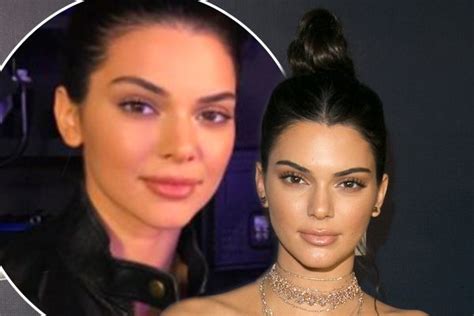 Kendall Jenner Slams Lip Filler Rumours ‘as A Model Why Would I Have My Face Reconstructed