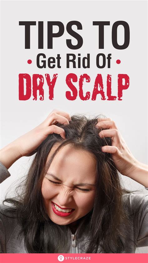 10 Best Home Remedies To Get Rid Of Dry Scalp In 2020 Dry Scalp Dry