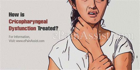 What Is Cricopharyngeal Dysfunction Causes Symptoms Treatment