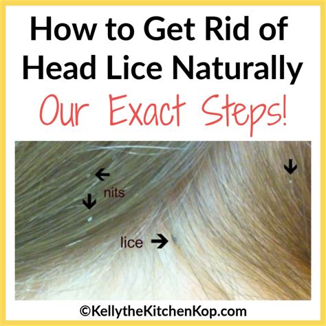 How To Get Rid Of Head Lice Naturally Kelly The Kitchen Kop