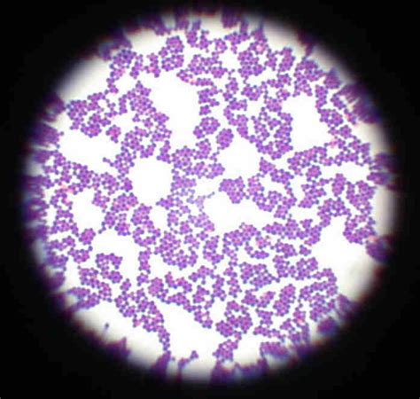 Staphylococcus aureus bacteria are pathogens to both man and other mammals. 10 best Staphylococcus aureus images on Pinterest ...