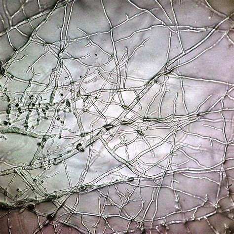 Using Fungi to Kill Weeds - Modern Agriculture Magazine