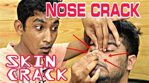 First Time Nose Crack Experience Skin Crack Lovely Head Massage By