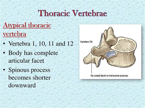 Atypical Thoracic Vertebrae 1