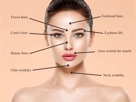 Common Botox Areas That Can Be Treated 8 Areas