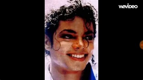 Michaeljackson Vitiligo Michael Jackson Did Not Bleach His Skin He