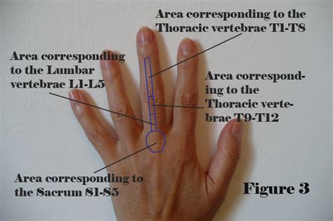 Questions and answers for it is sometimes called a bulging, protruding, or ruptured disk. back-pain-3 - Alternative Felix Healing Blog