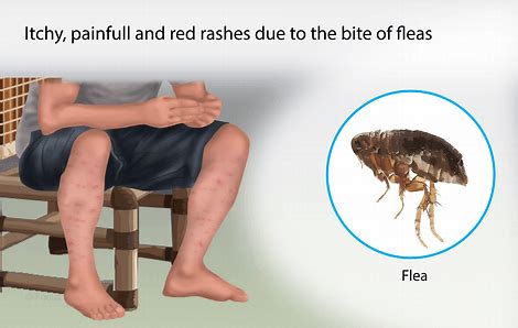 Treatment plan a good bed bug exterminator in philadelphia will come up with a treatment plan that will work effectively. Baxter Pest Control- Philadelphia- pest control, ant ...