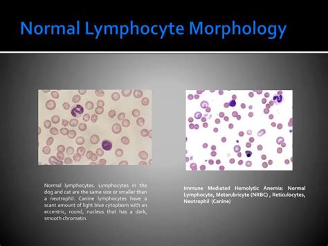 A lymphocyte is a type of white blood cell in the immune system of jawed vertebrates. PPT - Leukocytes WBC Morphology Clinical Pathology VTHT ...