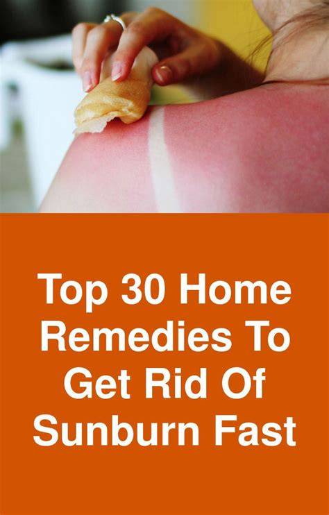 Top 30 Home Remedies To Get Rid Of Sunburn Fast Home Remedies For