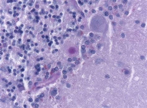 Could Scientists Really Create a Zombie Virus (Video) | UFO Sightings